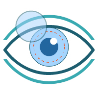 Cornea